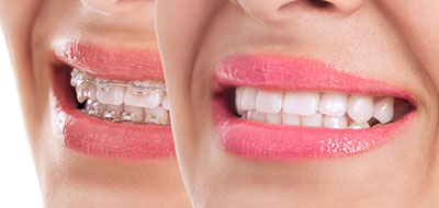 Uyesugi Dental | Dental Bridges, Veneers and Cosmetic Dentistry