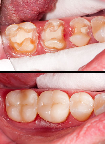 Uyesugi Dental | Laser Dentistry, Sedation Dentistry and Oral Exams