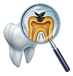 Uyesugi Dental | ZOOM  Whitening, Periodontal Treatment and Invisalign reg 