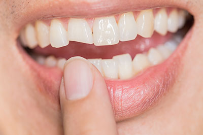 Uyesugi Dental | Cosmetic Dentistry, HealthyStart   and Dental Cleanings