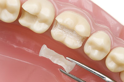 Uyesugi Dental | HealthyStart  , Cosmetic Dentistry and Oral Exams