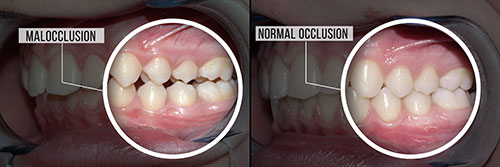 Uyesugi Dental | Periodontal Treatment, Invisalign reg  and Preventative Program