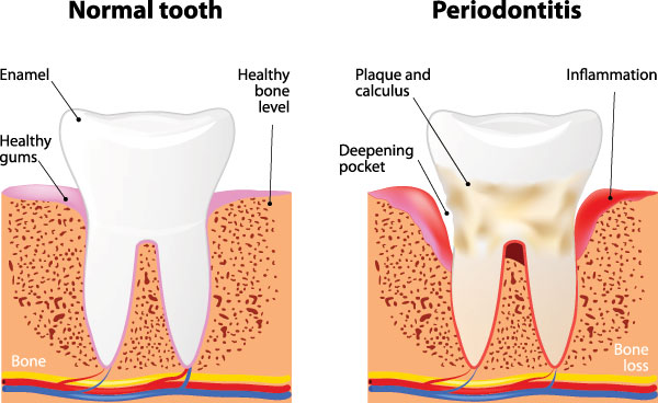 Uyesugi Dental | Invisalign reg , Periodontal Treatment and Laser Dentistry