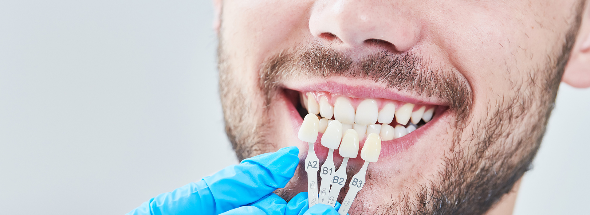Uyesugi Dental | Inlays  amp  Onlays, Pearl AI X-Rays and Dental Sealants